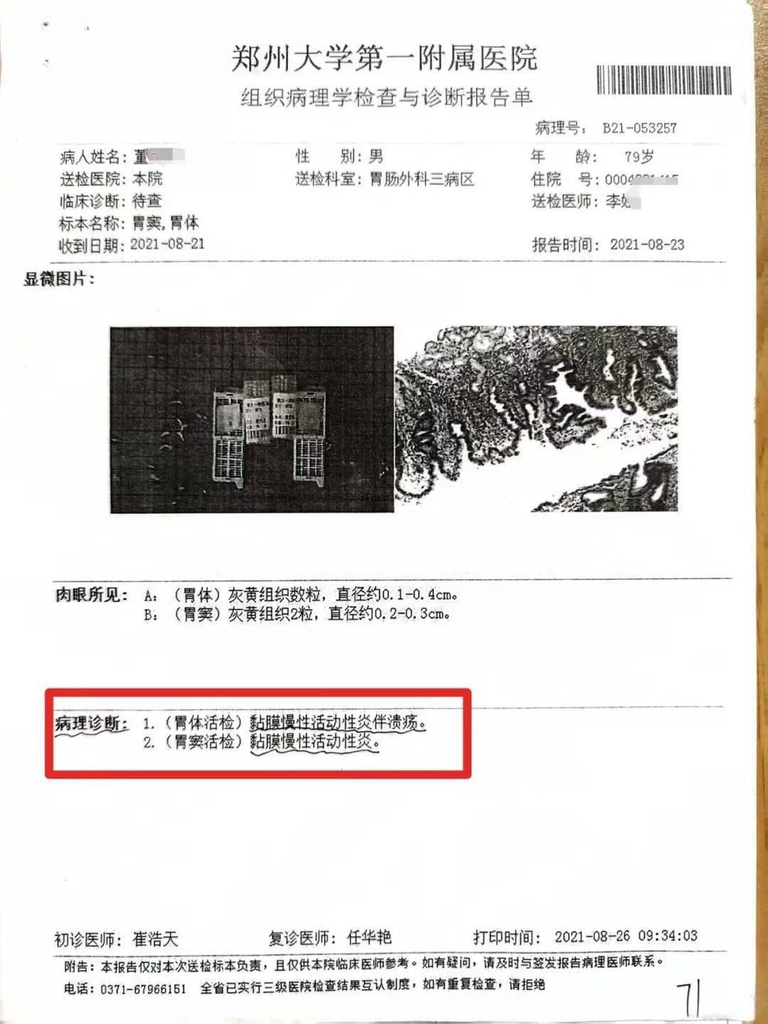 79岁老人患慢性胃炎，郑大一附院被指按胃癌晚期切除全胃