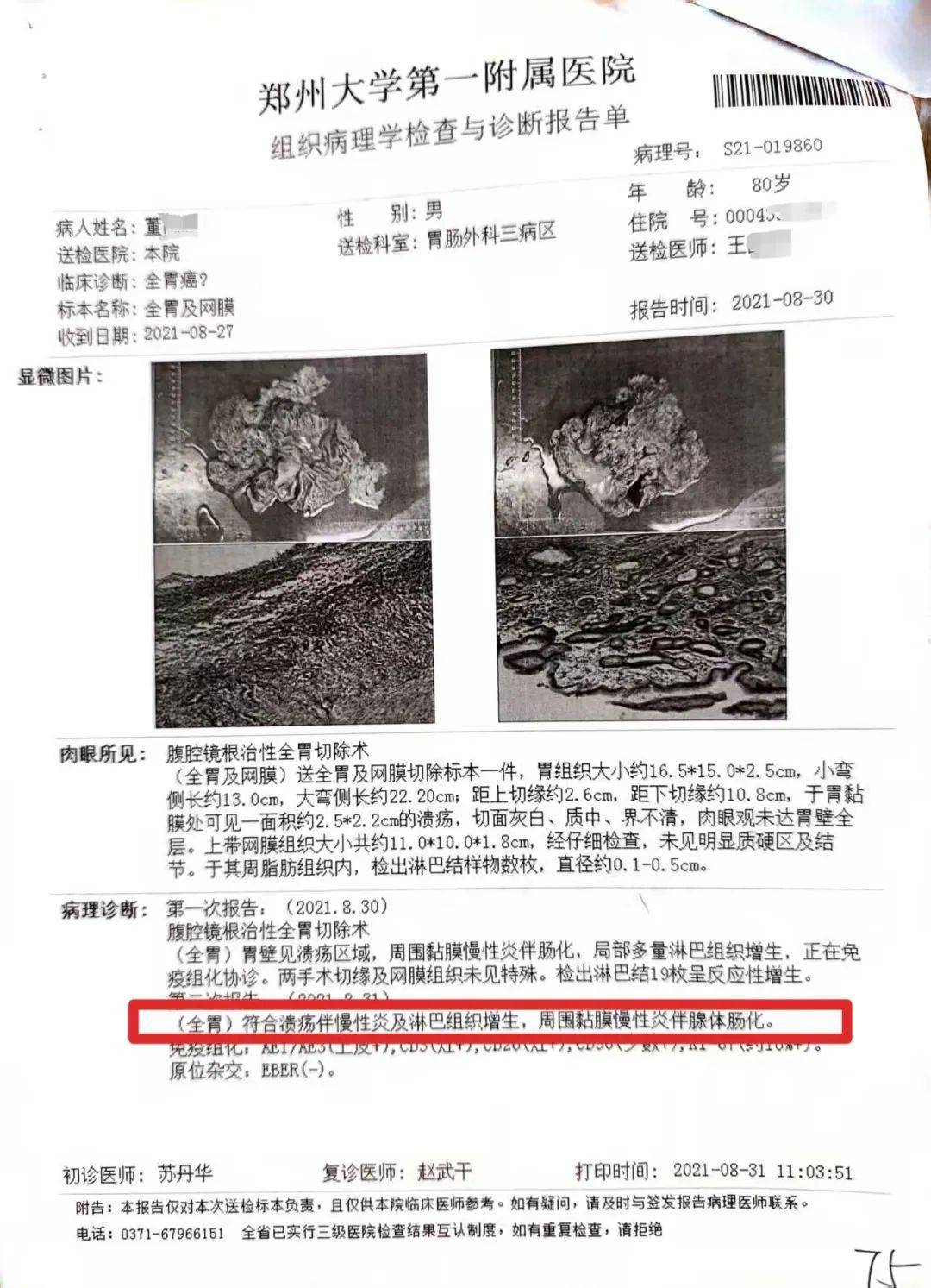 79岁老人患慢性胃炎，郑大一附院被指按胃癌晚期切除全胃